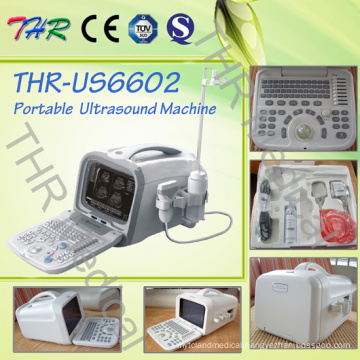 Portable Digital 3D B/W Ultrasound Scanner (THR-US6602)